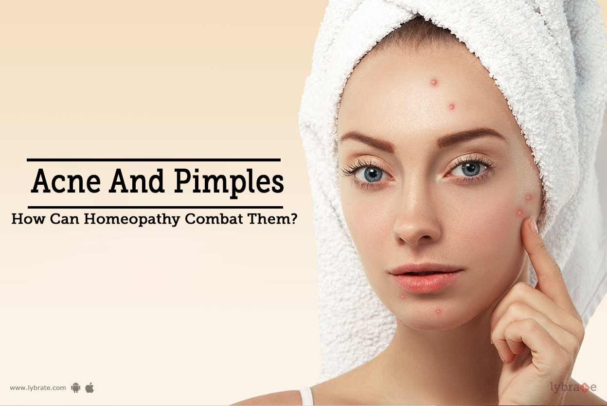 Acne And Pimples - How Can Homeopathy Combat Them?