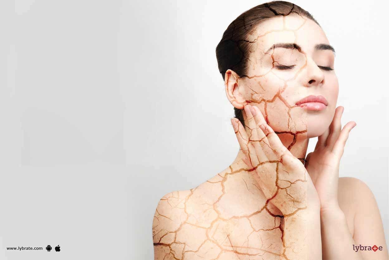 Dry Skin - Know Common Questions Related To It!