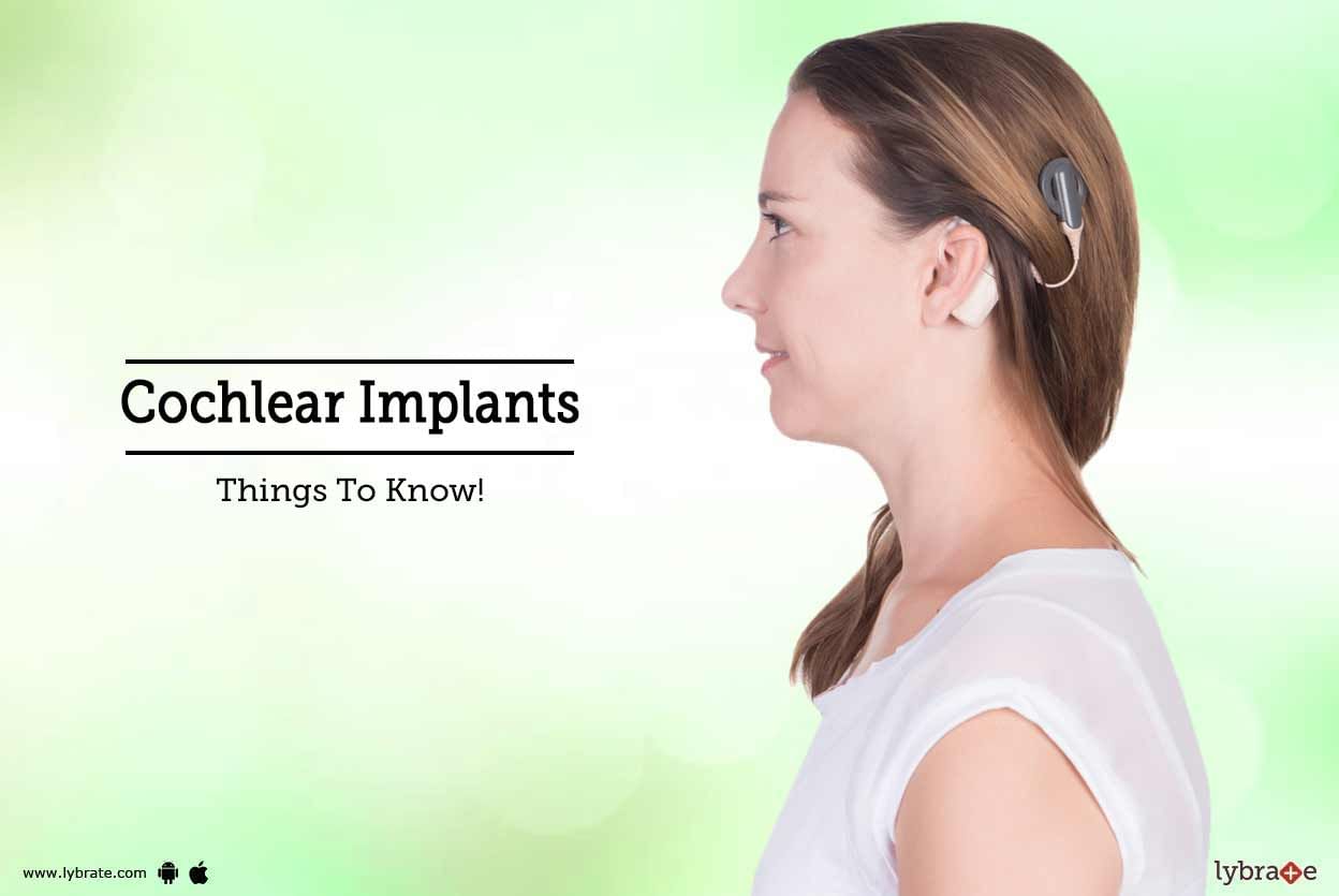 Cochlear Implants - Things To Know!
