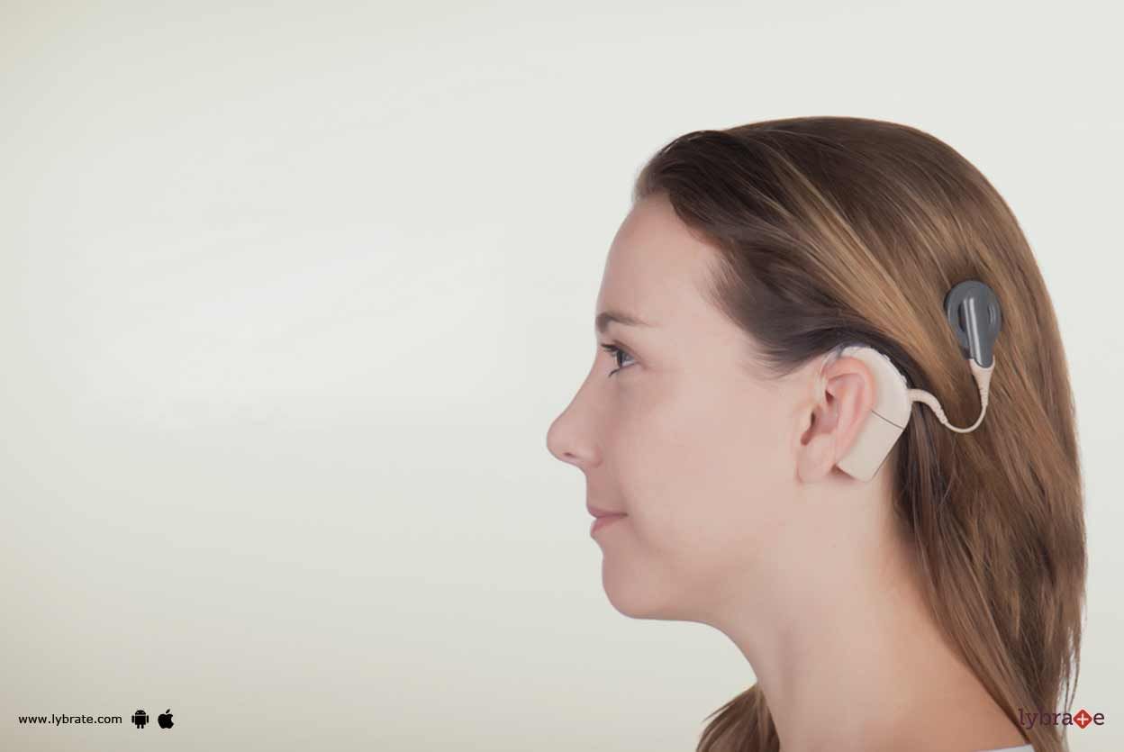 Cochlear Implants - Know More About Them!