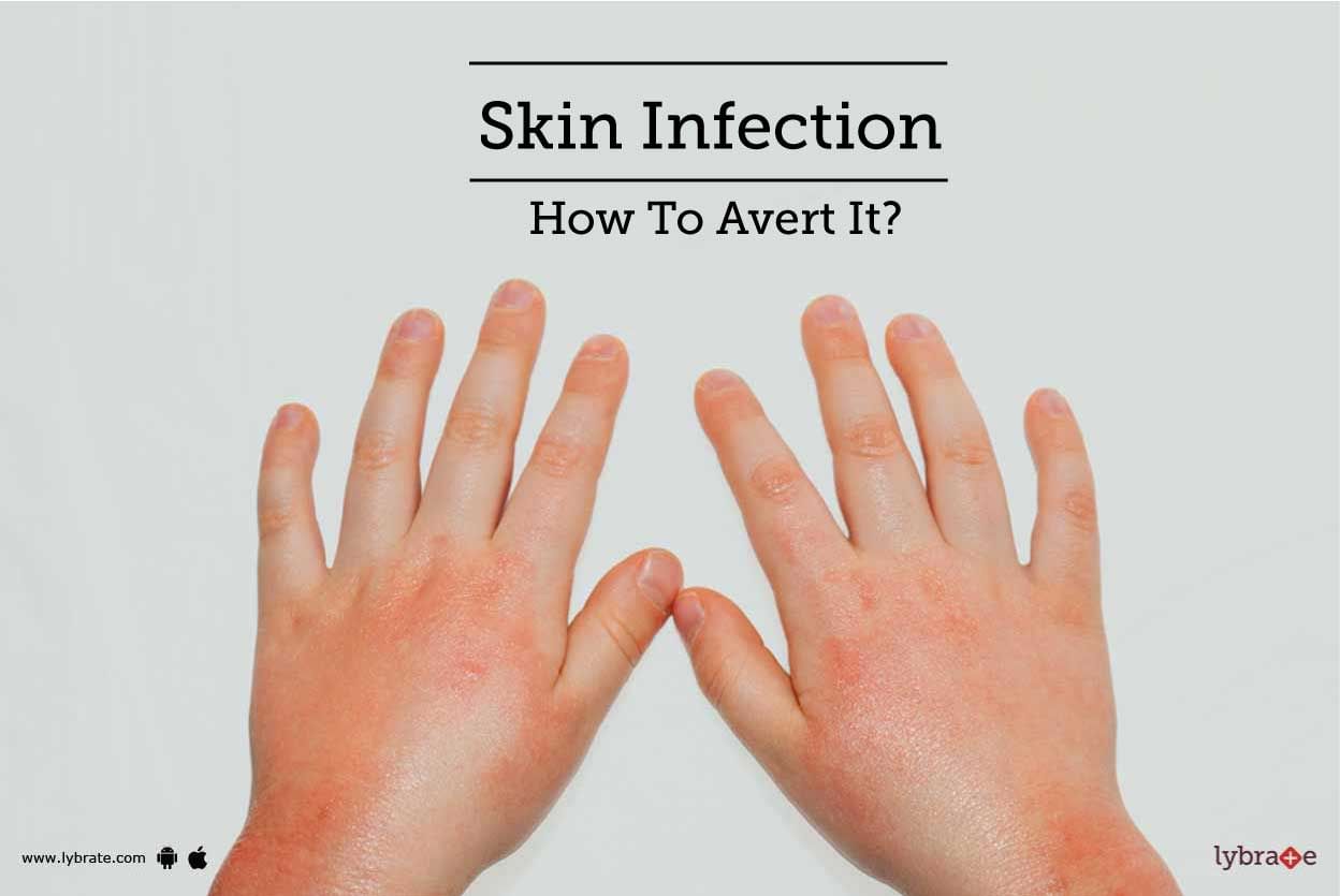 Skin Infection - How To Avert It?