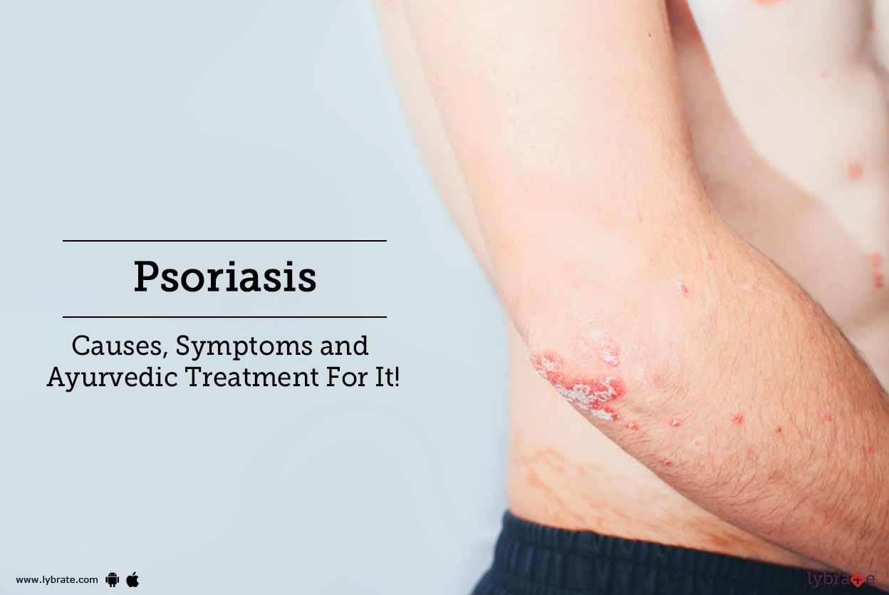 Psoriasis - Causes, Symptoms and Ayurvedic Treatment For It!