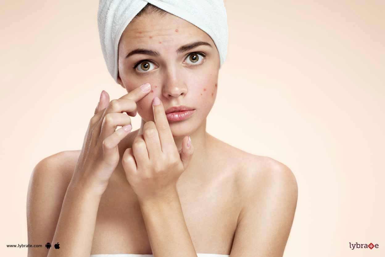 Microneedling Radio Frequency - How Can It Handle Acne Scars?