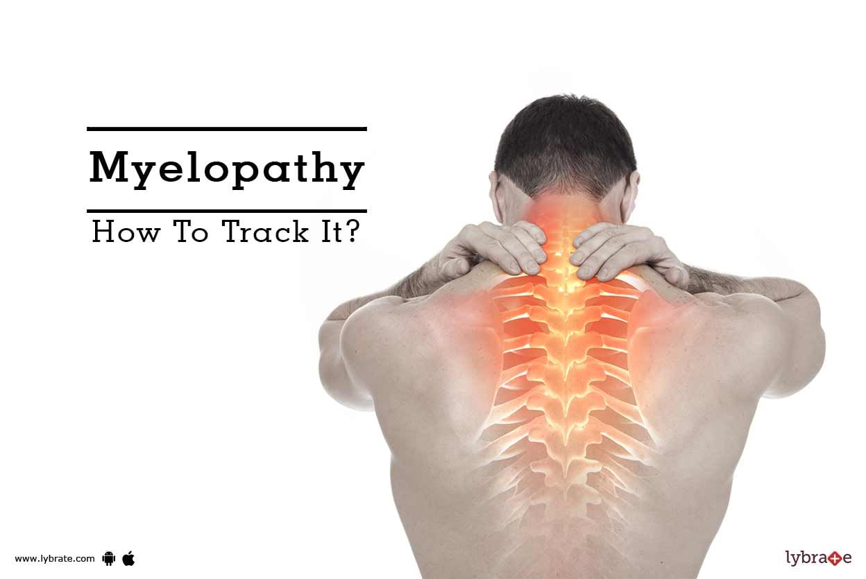 Myelopathy - How To Track It?