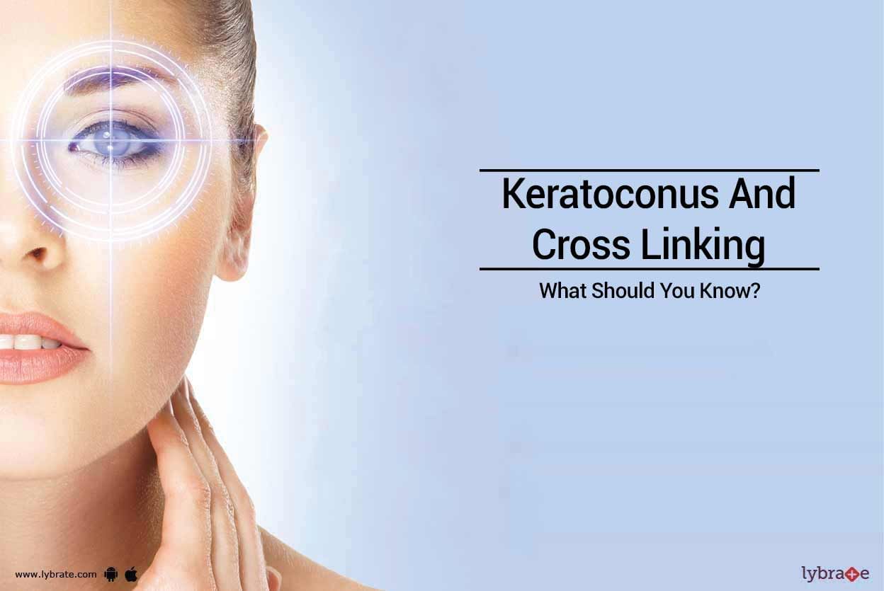 Keratoconus And Cross Linking - What Should You Know?