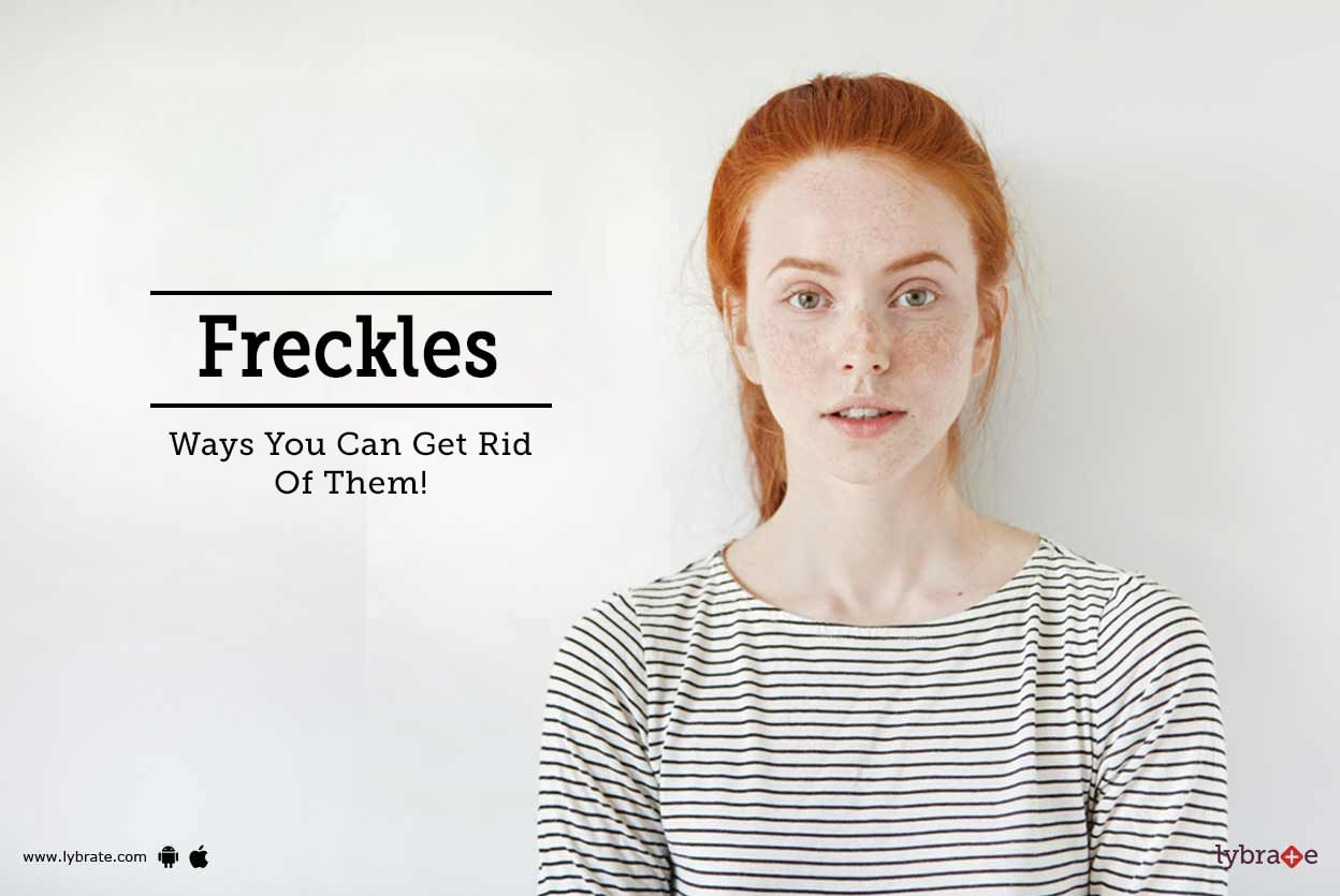 Freckles - Ways You Can Get Rid Of Them!