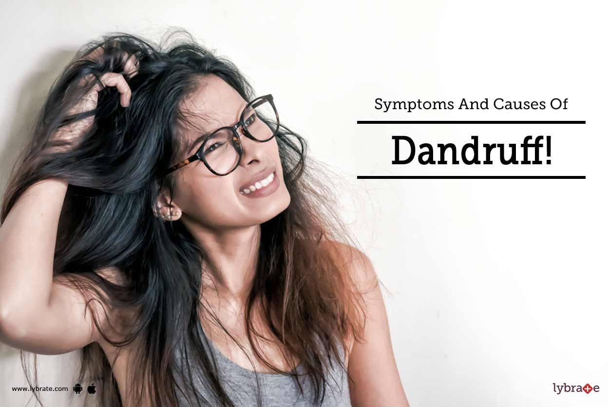 Symptoms And Causes Of Dandruff!