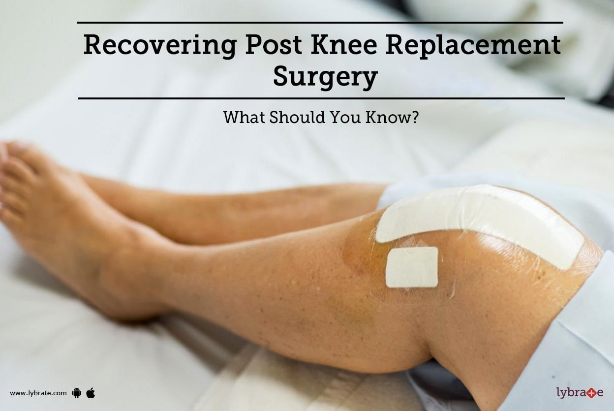 Recovering Post Knee Replacement Surgery - What Should You Know?