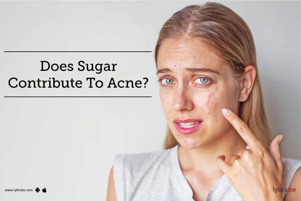 Does Sugar Contribute To Acne?