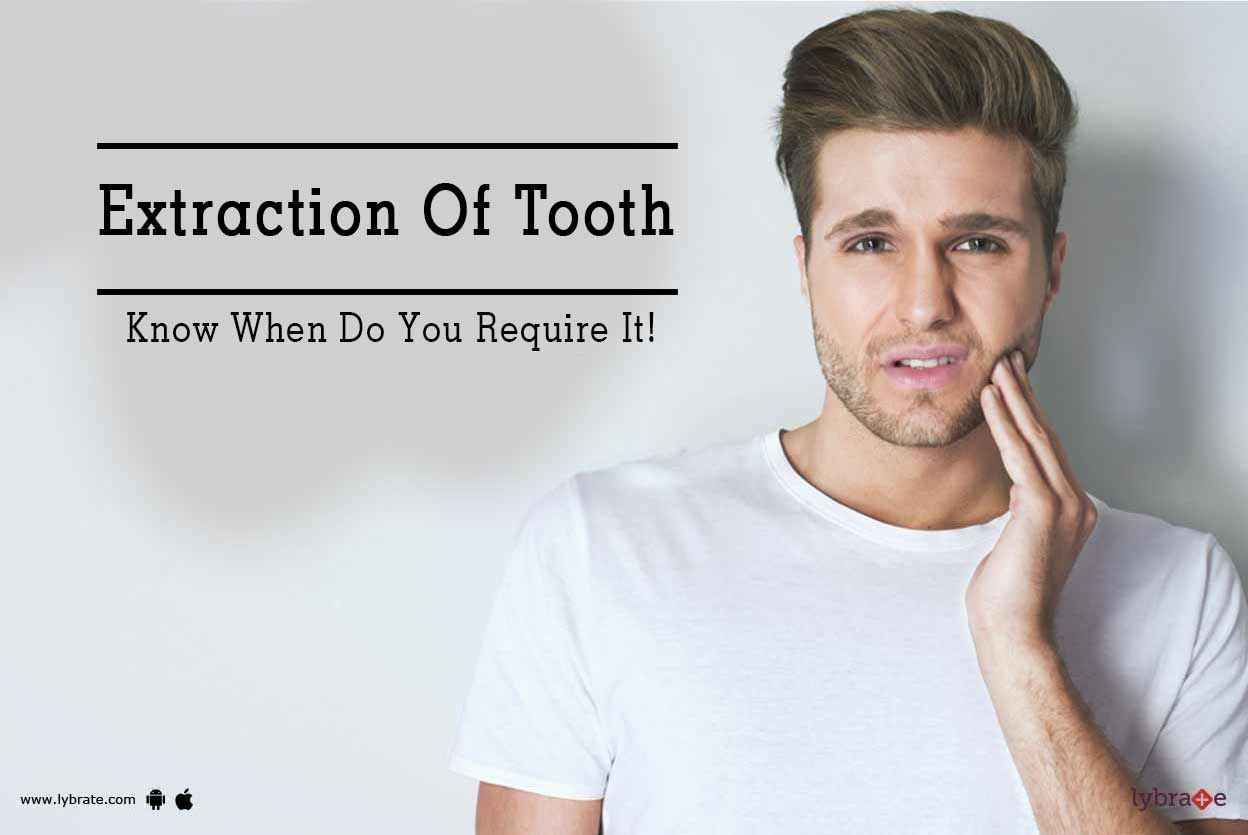 Extraction Of Tooth - Know When Do You Require It!