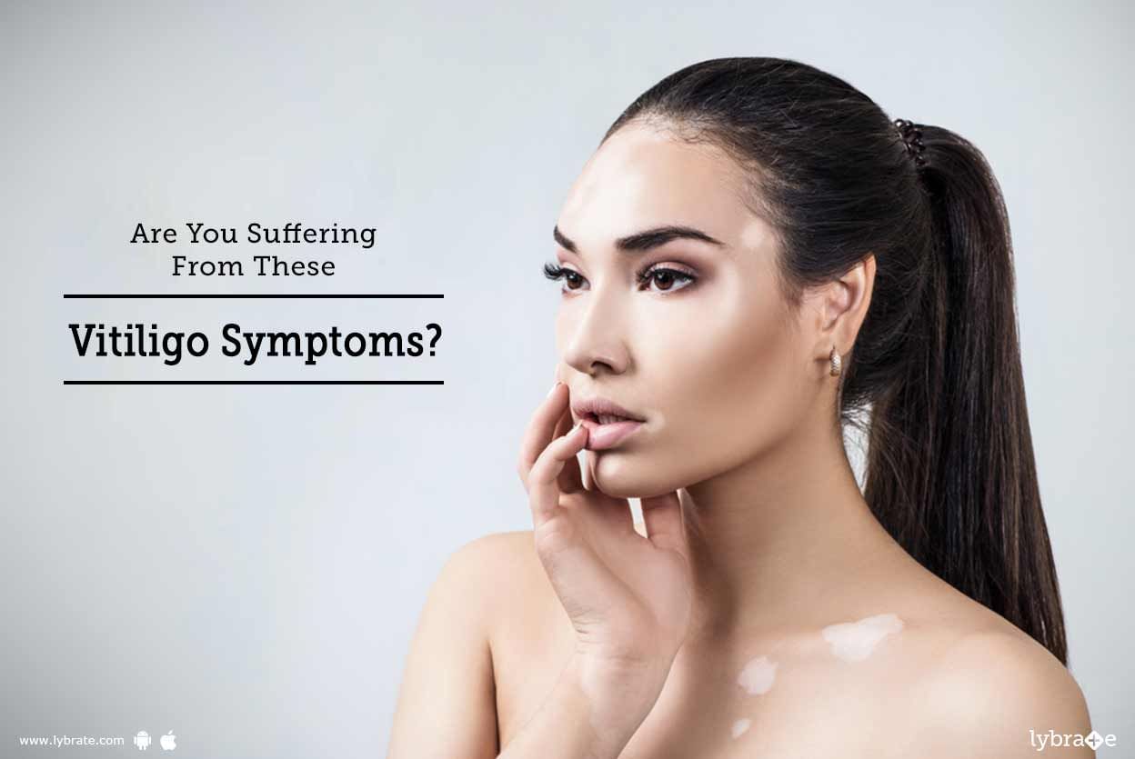Are You Suffering From These Vitiligo Symptoms?
