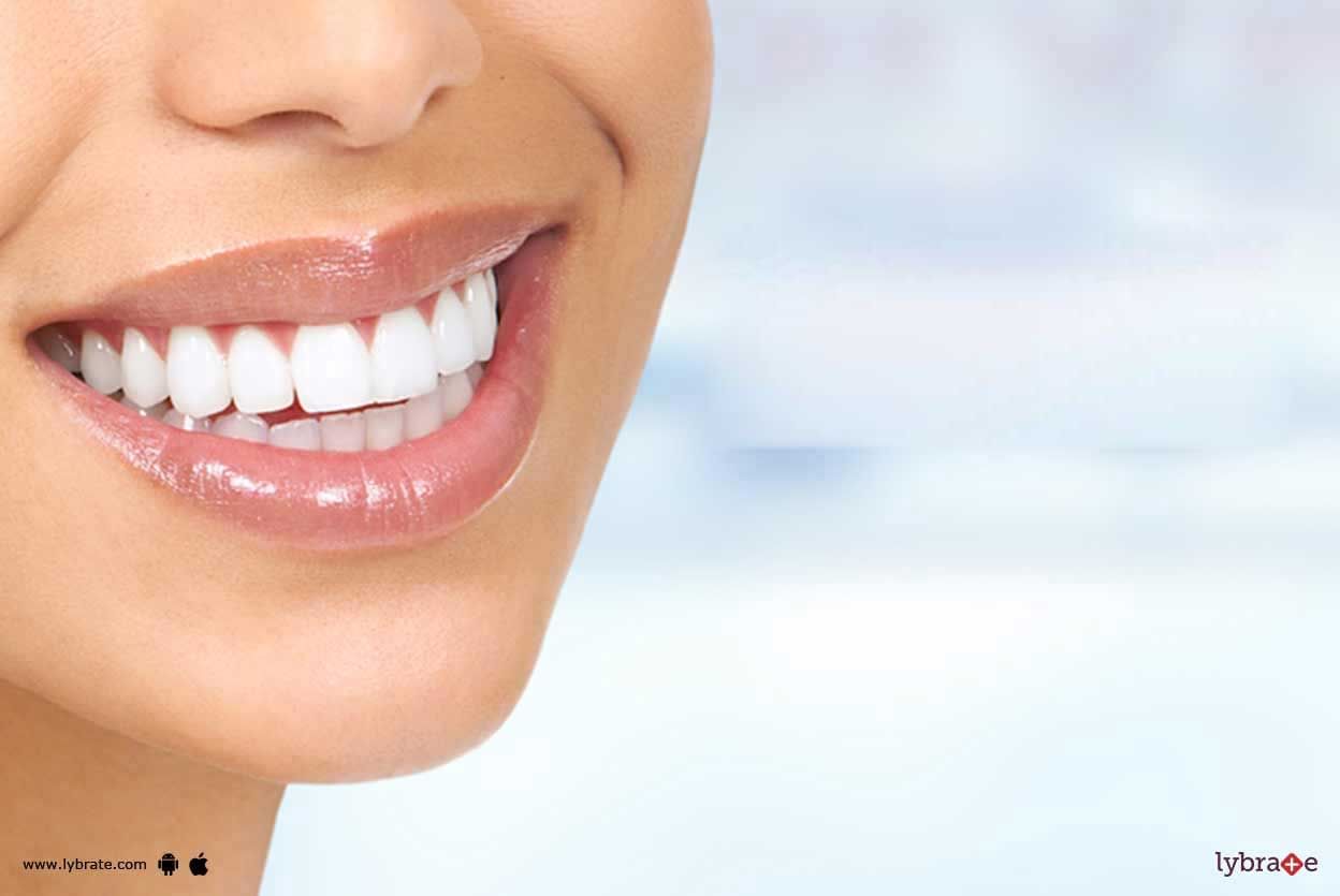 Teeth Whitening - Who Are Eligible For It?