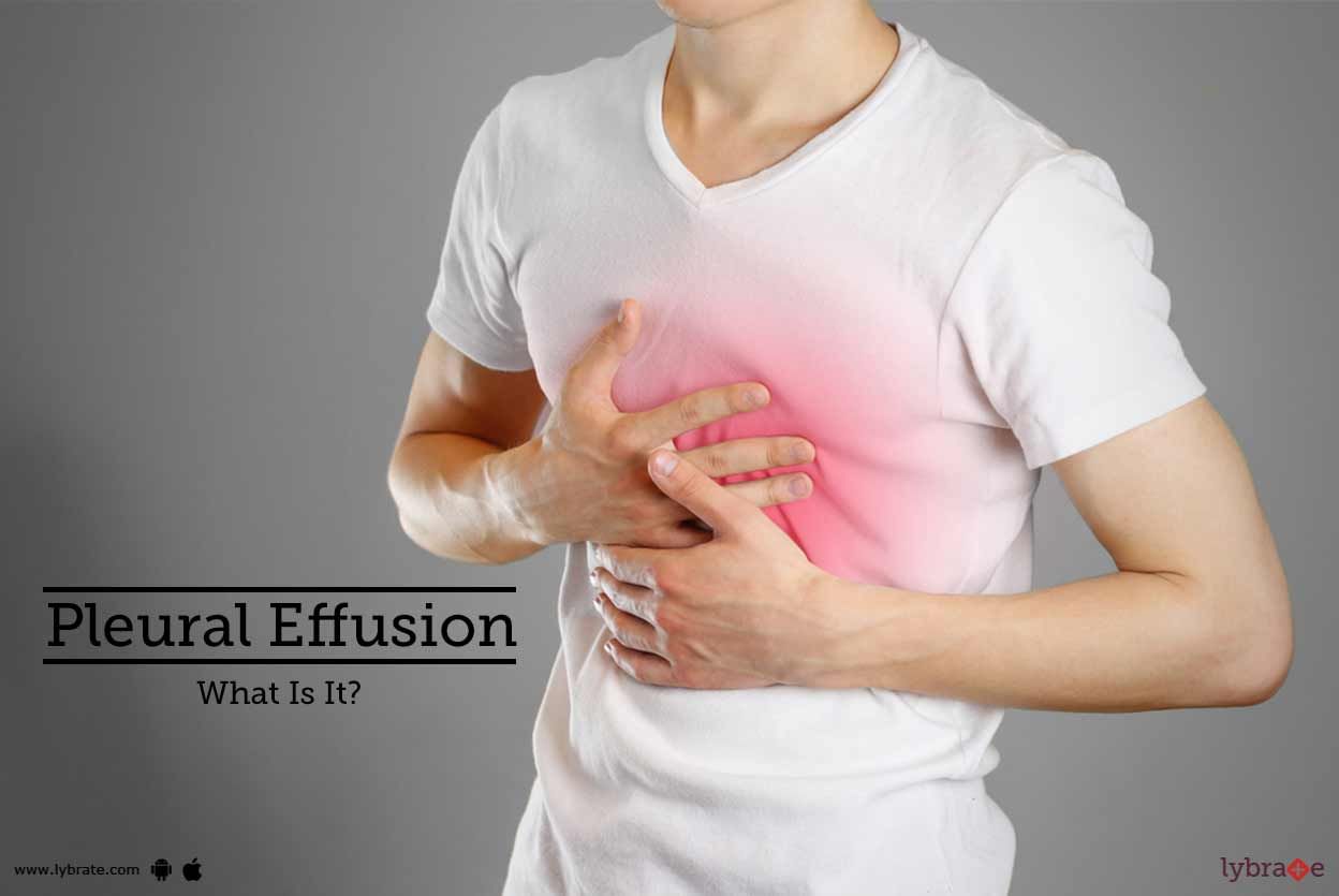 Pleural Effusion - What Is It?