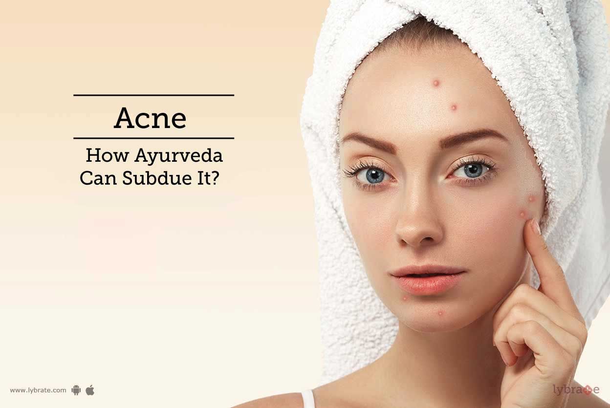 Acne - How Ayurveda Can Subdue It?