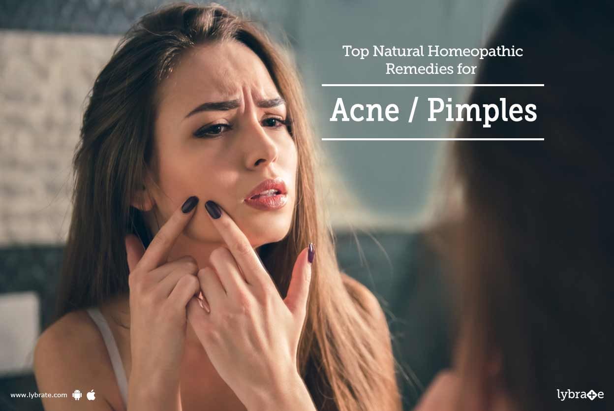 Top Natural Homeopathic Remedies for Acne / Pimples