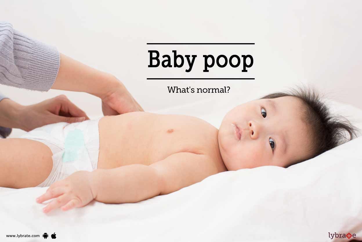 Baby poop: What's normal?