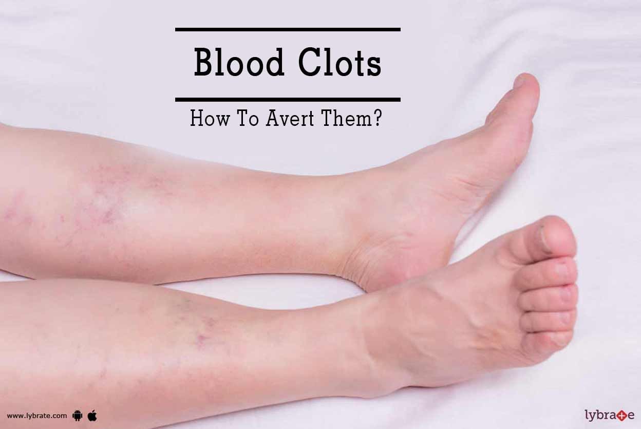 Blood Clots - How To Avert Them?