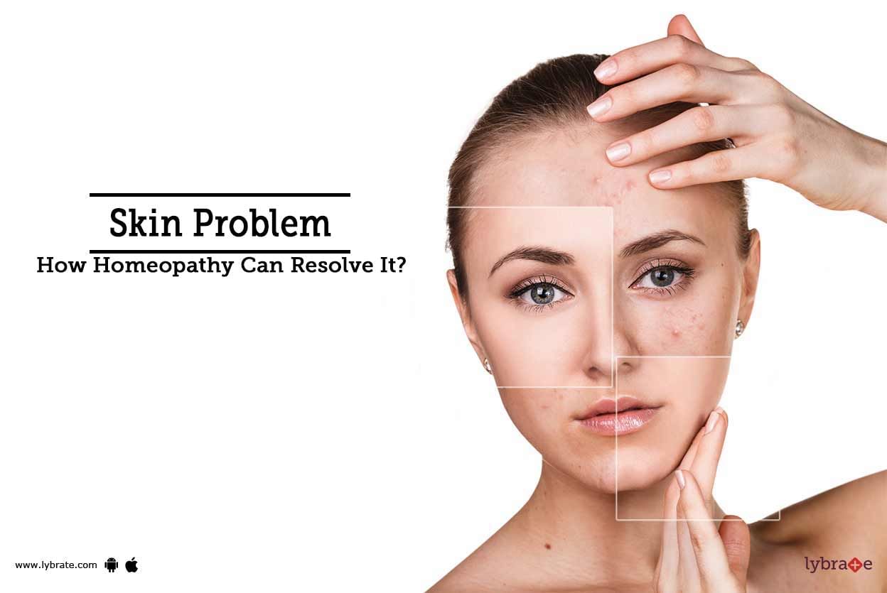 Skin Problem - How Homeopathy Can Resolve It?