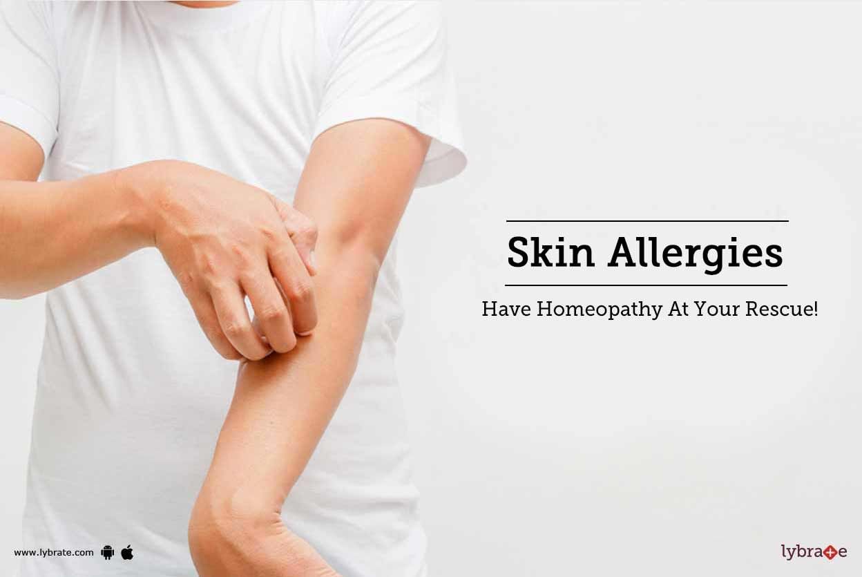 Skin Allergies - Have Homeopathy At Your Rescue!