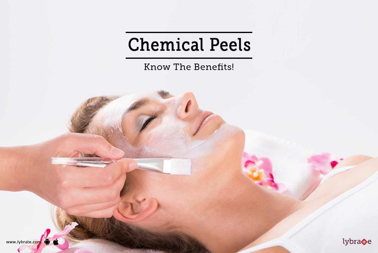Chemical Peels - Know The Benefits!