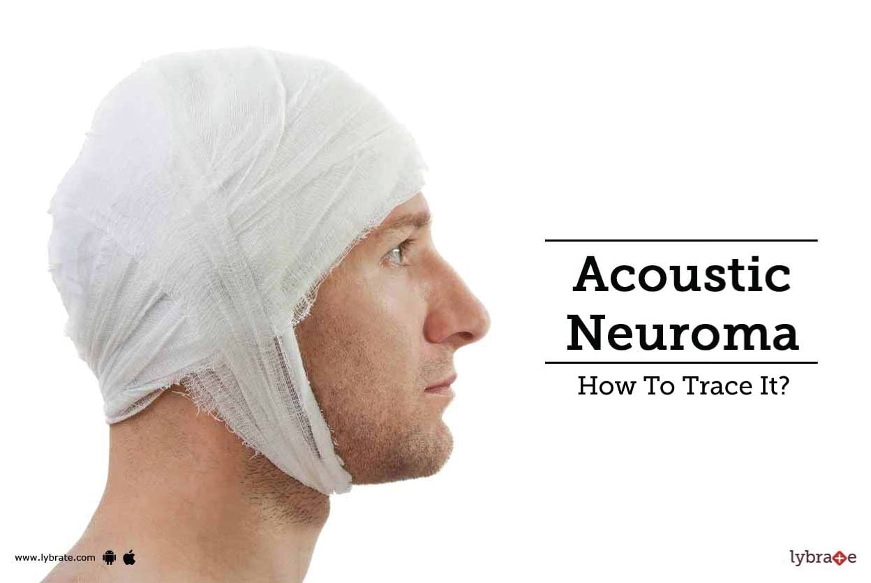 Acoustic Neuroma - How To Trace It?