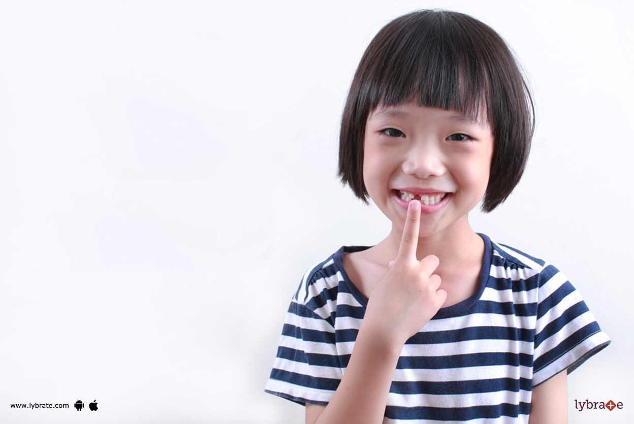 Broken Front Tooth In Children - How To Manage It?