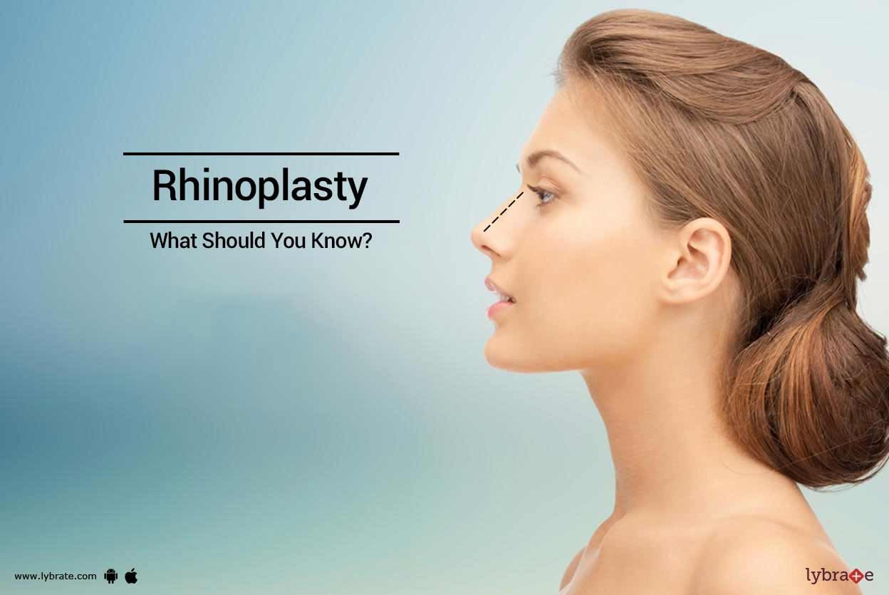 Rhinoplasty - What Should You Know?