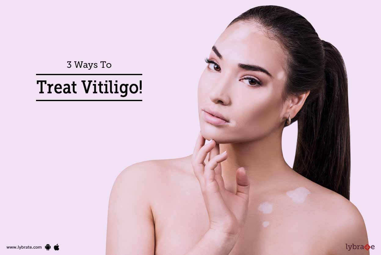 3 Ways To Treat Vitiligo!