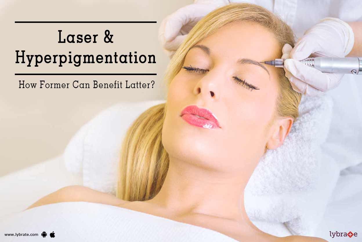 Laser & Hyperpigmentation  - How Former Can Benefit Latter?