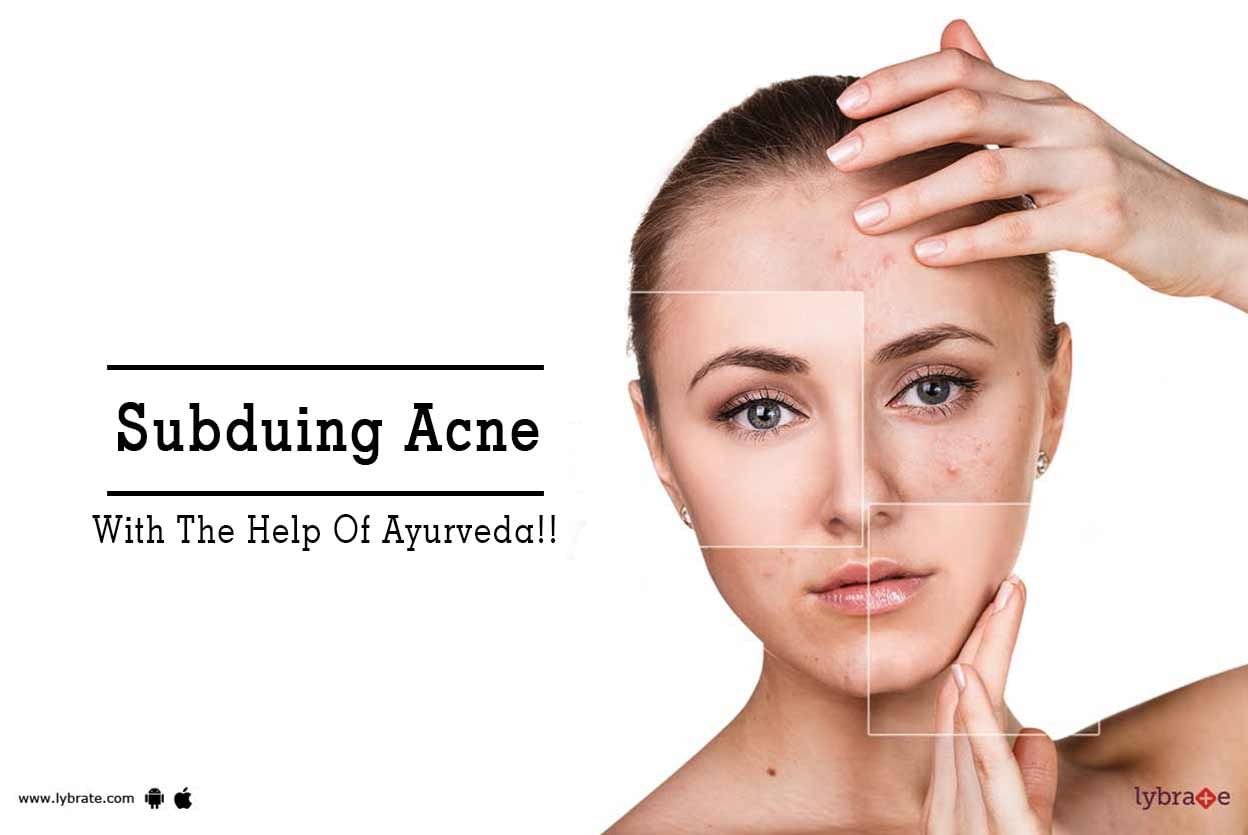Subduing Acne With The Help Of Ayurveda!!