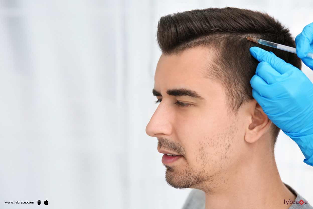 Hair Transplant - How To Take Care Post It?
