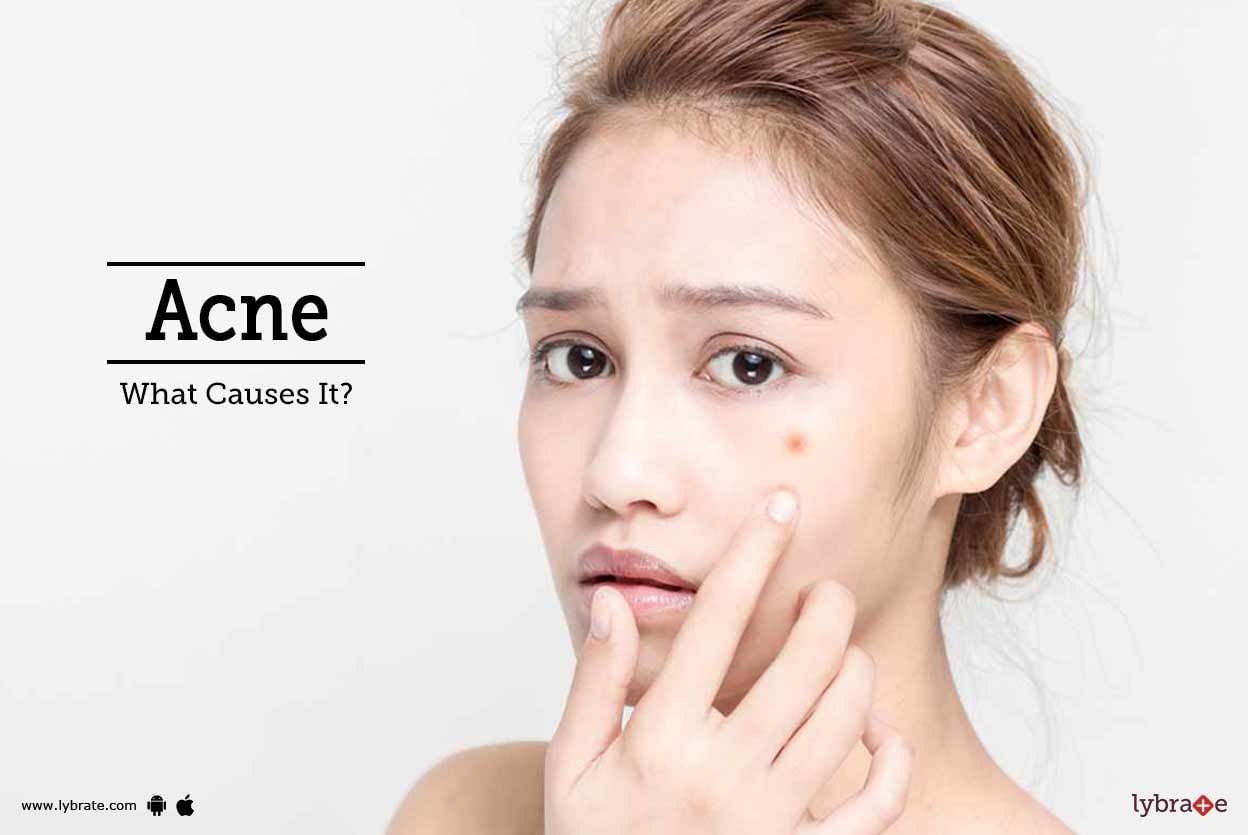 Acne - What Causes It?