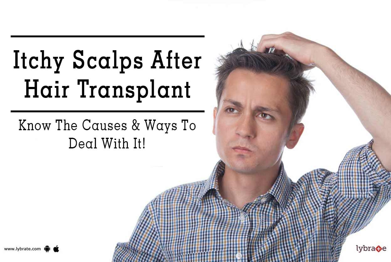 Itchy Scalps After Hair Transplant - Know The Causes & Ways To Deal With It!