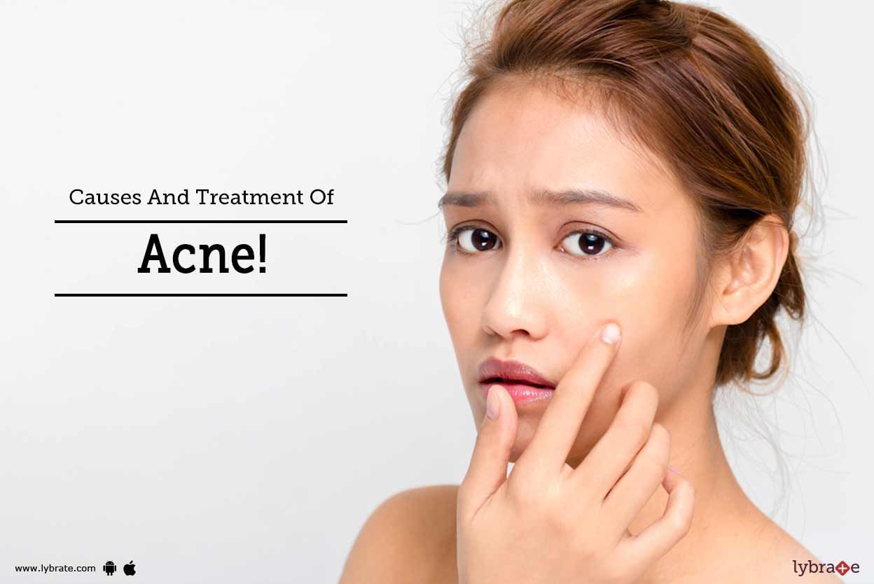 Causes And Treatment Of Acne!