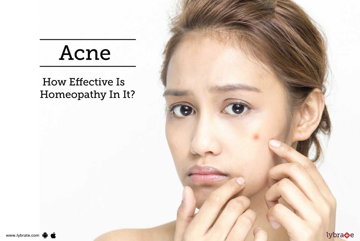 Acne - How Effective Is Homeopathy In It?
