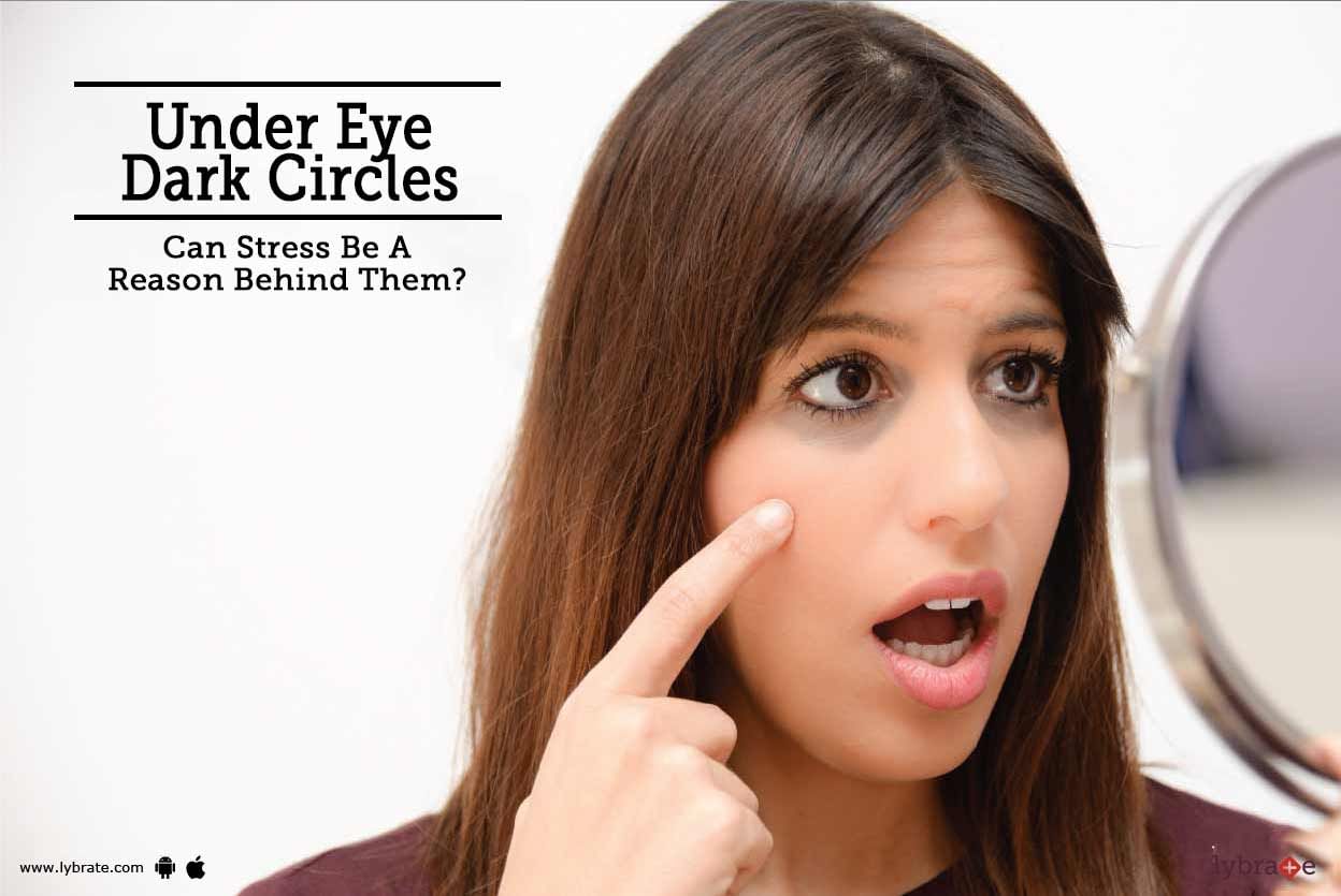 Under Eye Dark Circles - Can Stress Be A Reason Behind Them?