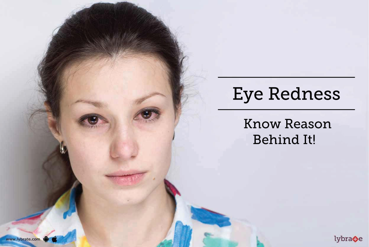 Eye Redness - Know Reason Behind It!