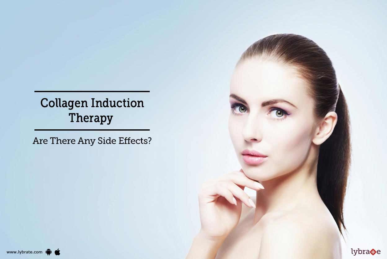 Collagen Induction Therapy - Are There Any Side Effects?
