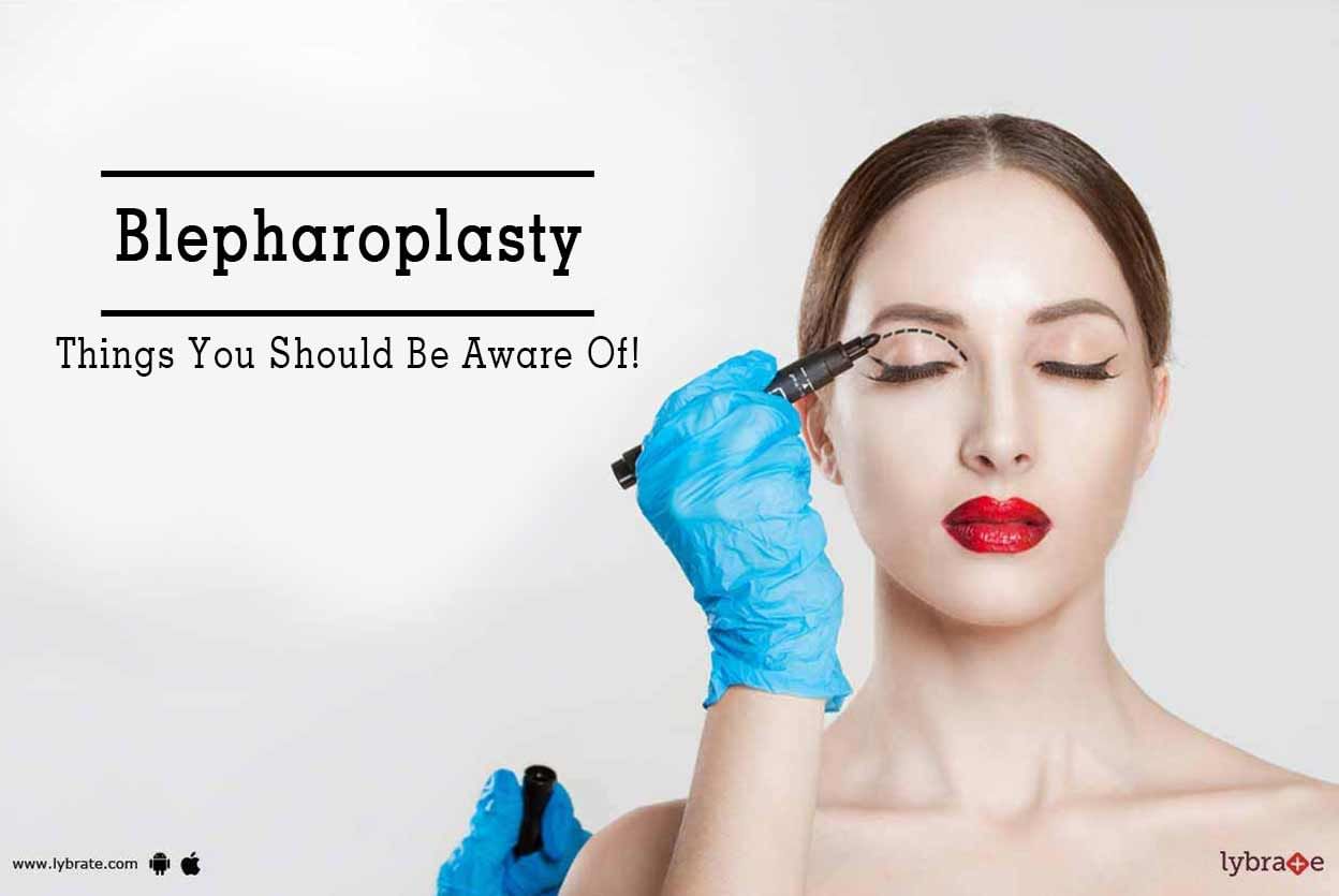 Blepharoplasty - Things You Should Be Aware Of!