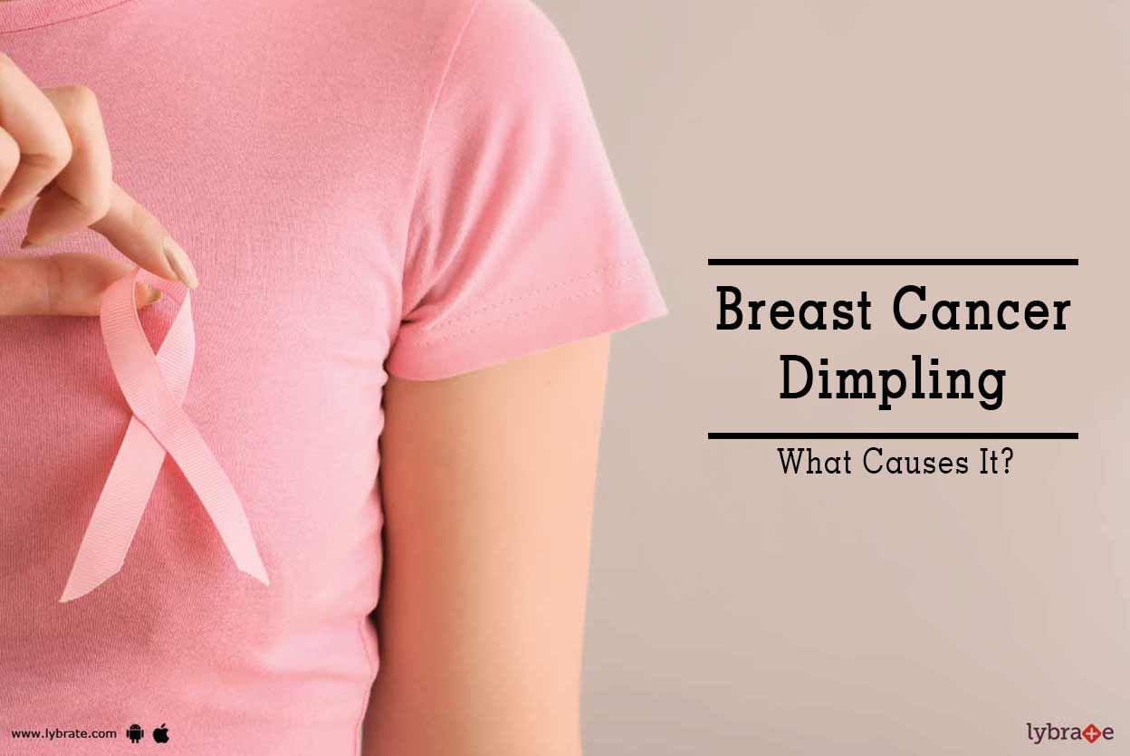 Breast Cancer Dimpling - What Causes It?
