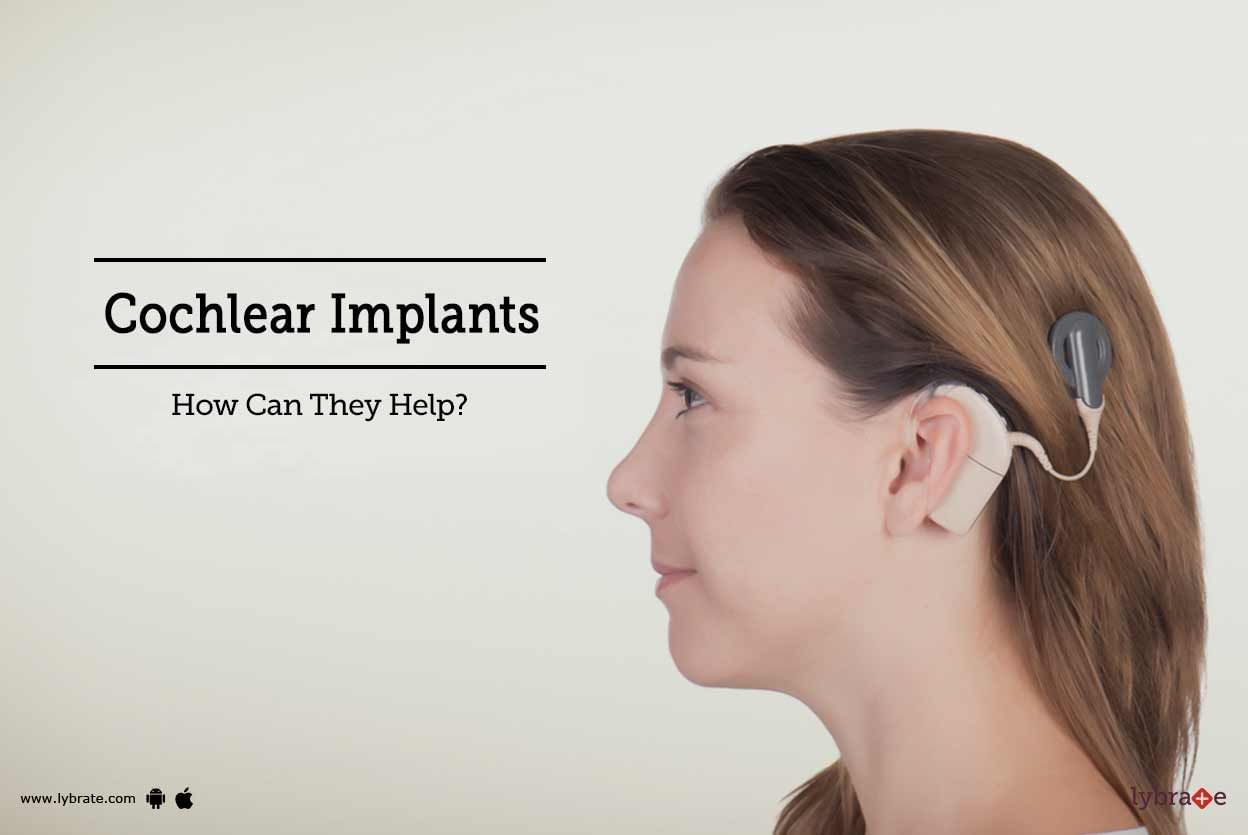 Cochlear Implants - How Can They Help?