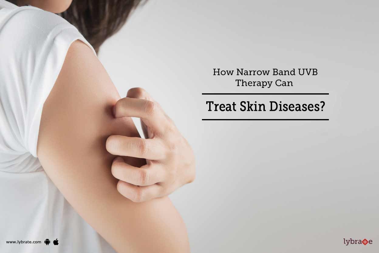How Narrow Band UVB Therapy Can Treat Skin Diseases?