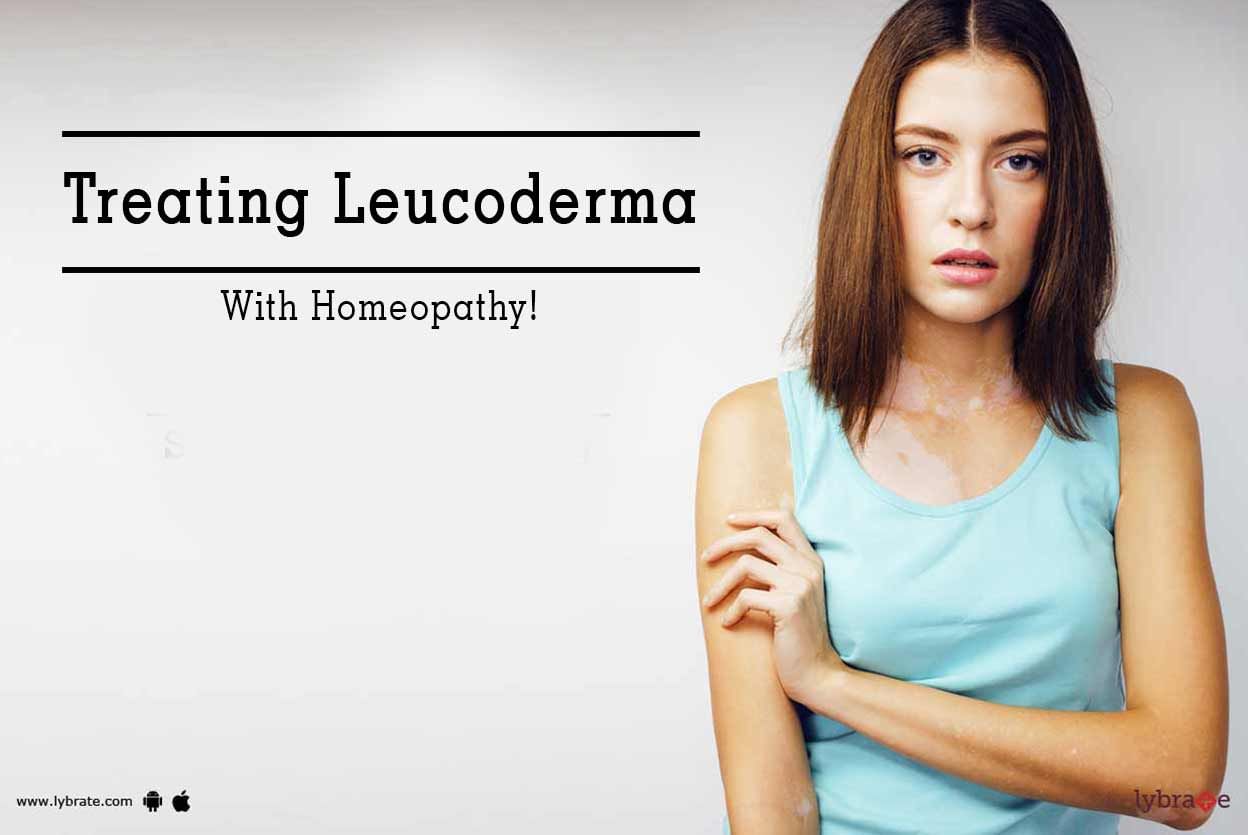 Treating Leucoderma With Homeopathy!