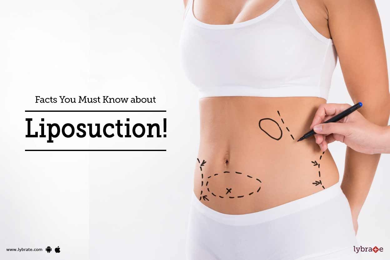 Facts You Must Know about Liposuction!