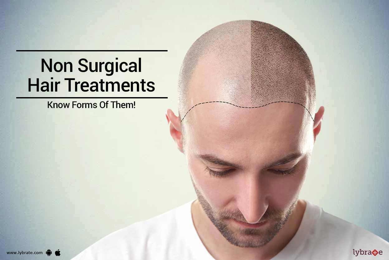 Non Surgical Hair Treatments - Know Forms Of Them!