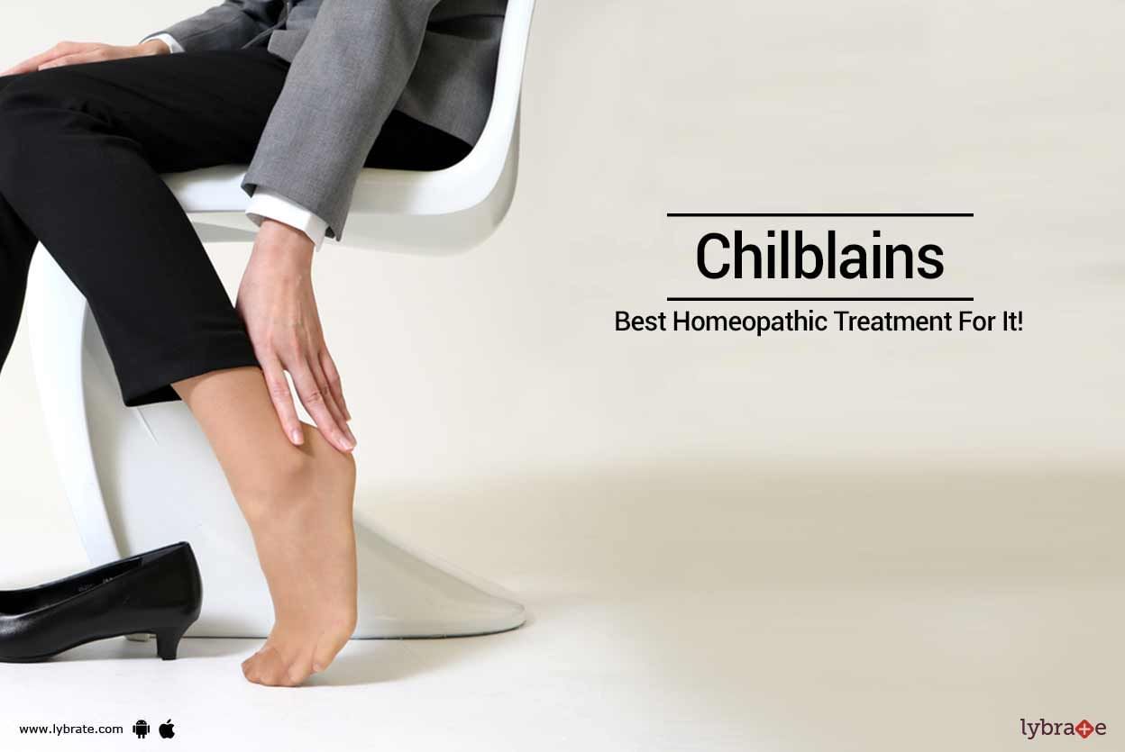 Chilblains - Best Homeopathic Treatment For It!