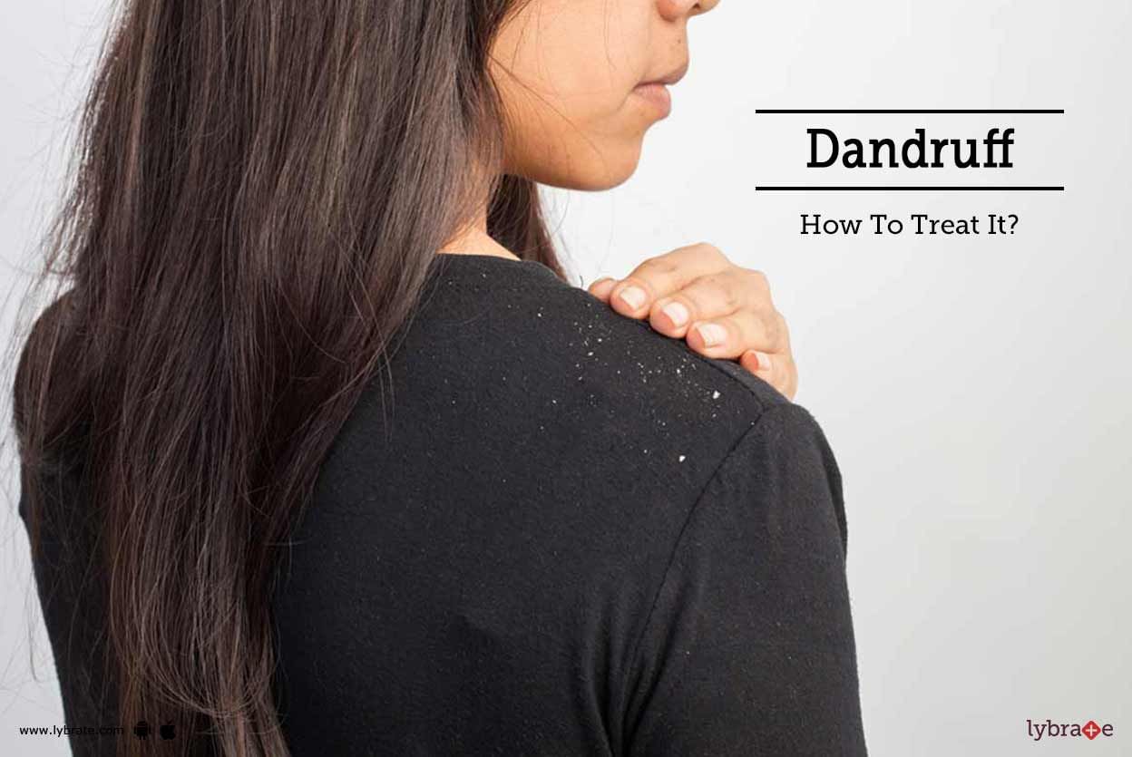 Dandruff - How To Treat It?