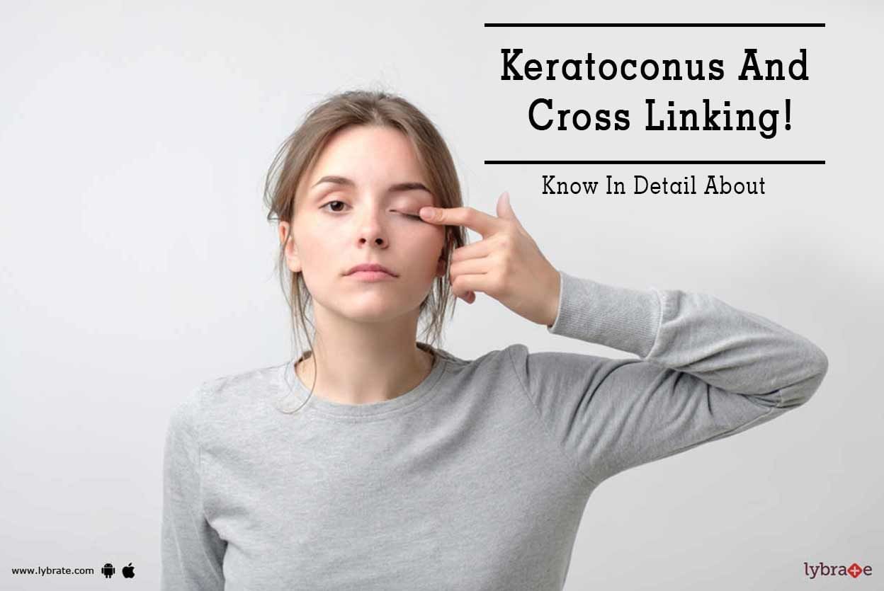 Know In Detail About Keratoconus And Cross Linking!