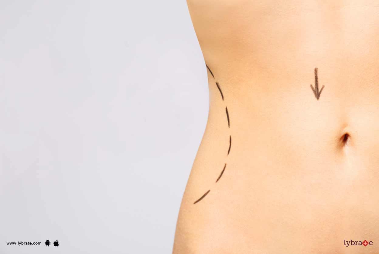 Body Contouring - All You Must Know About It!