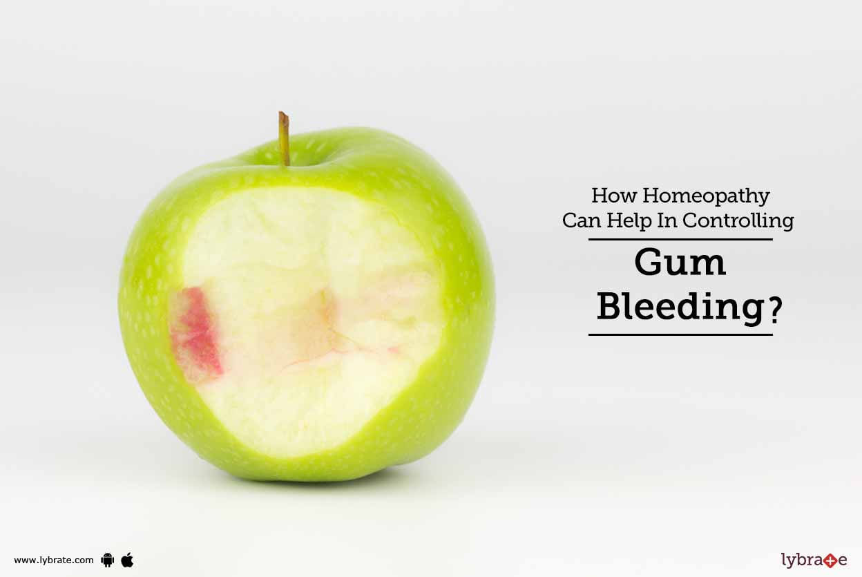 How Homeopathy Can Help In Controlling Gum Bleeding?